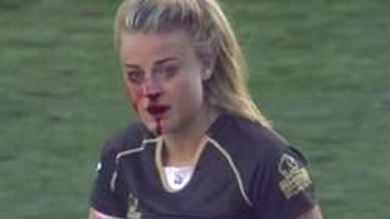 Eltörték az orrát, duplán állt bosszút a női rögbis - videó