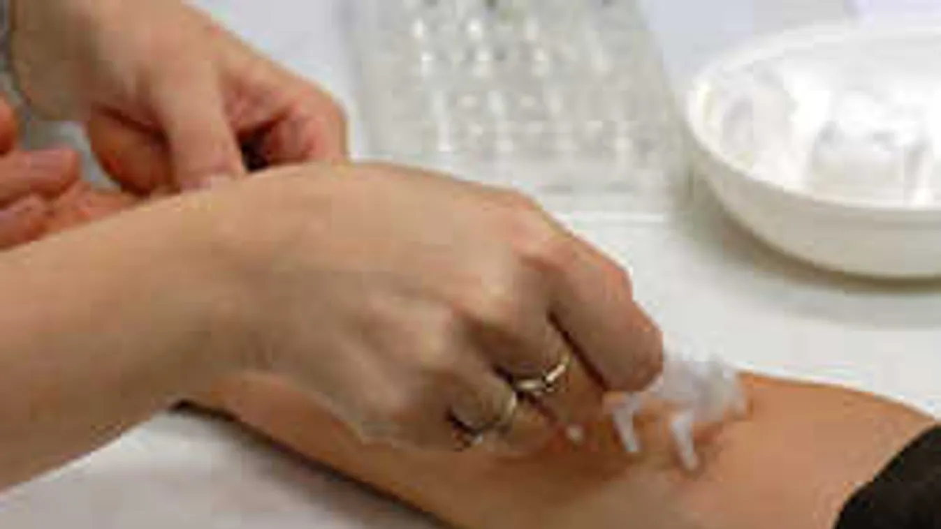 Bajban az allergiások: Újra támad a pollen, vörösbe borult az ország