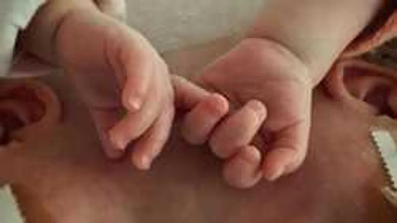 Orvosi csoda: sikeresen szétválasztották a fejüknél összenőtt sziámi ikreket