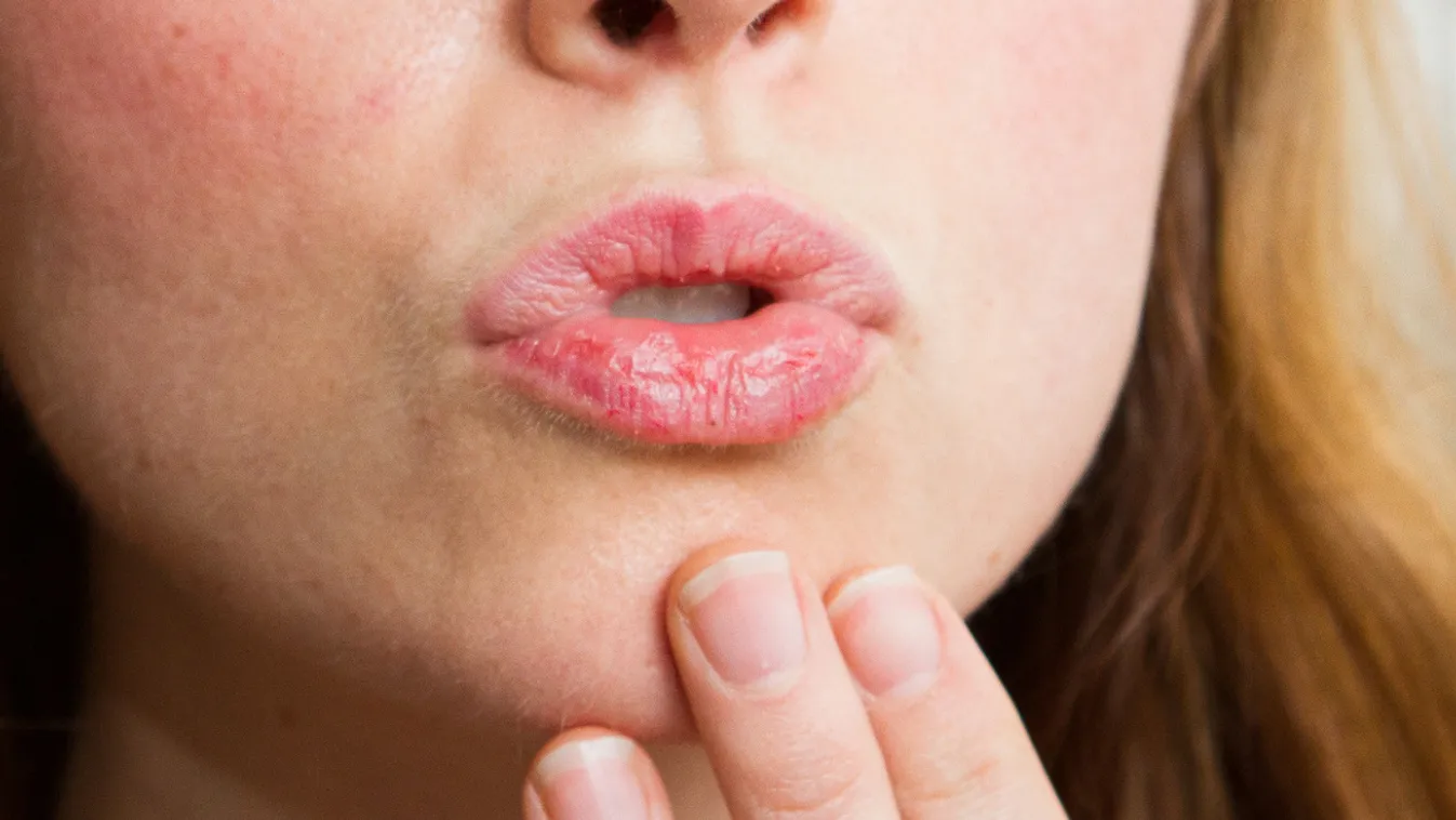 Veszélyes szépségtrükk terjed a neten, pillanatragasztót kennek magukra a nők