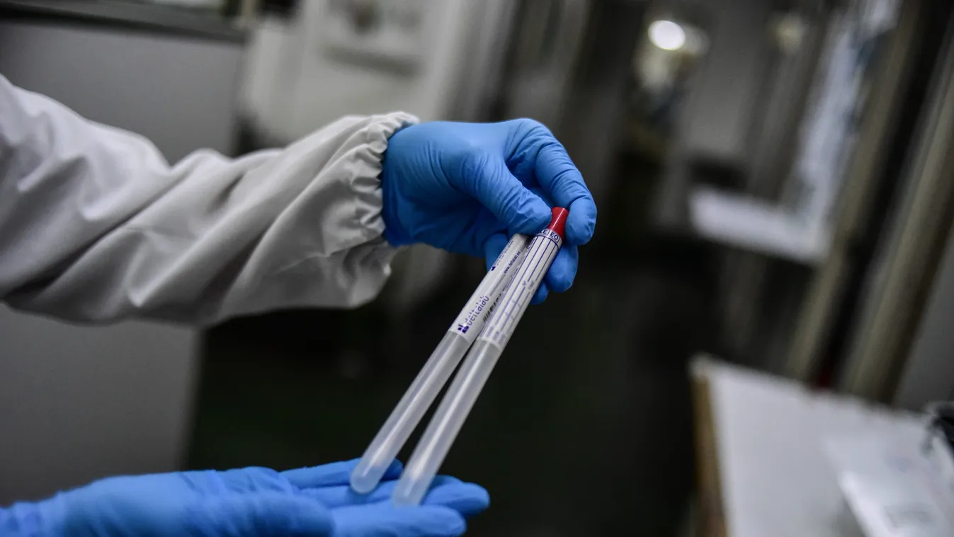 Buenos Aires Hospital Analyses Samples To Detect COVID-19