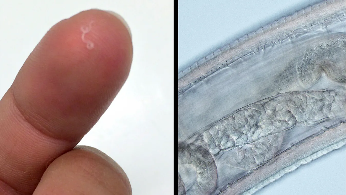 Az orvosok elsápadtak, durva, mi történt a nő szemével kocogás közben