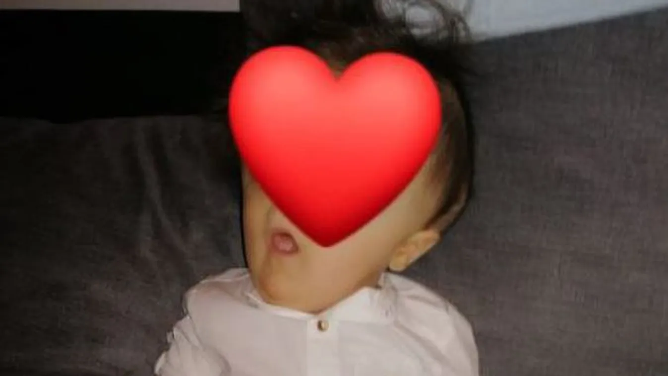 Valóságos csoda: Első szülinapját ünnepelte az arc nélkül született kisfiú