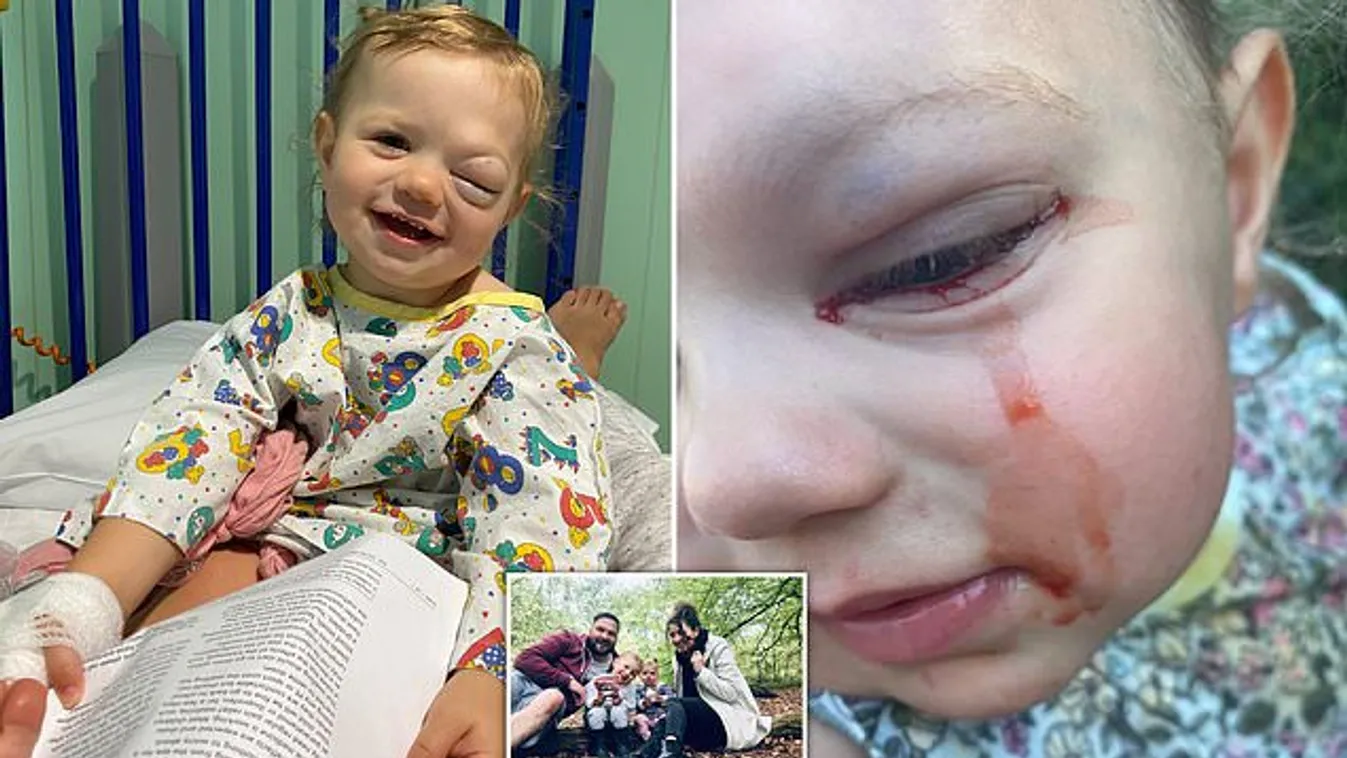„Rettenetesen aggódtunk„ – könnyek helyett vér folyik a kislány szeméből
