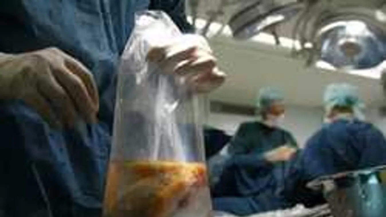 Szegények veséivel kereskedett egy ukrán banda!