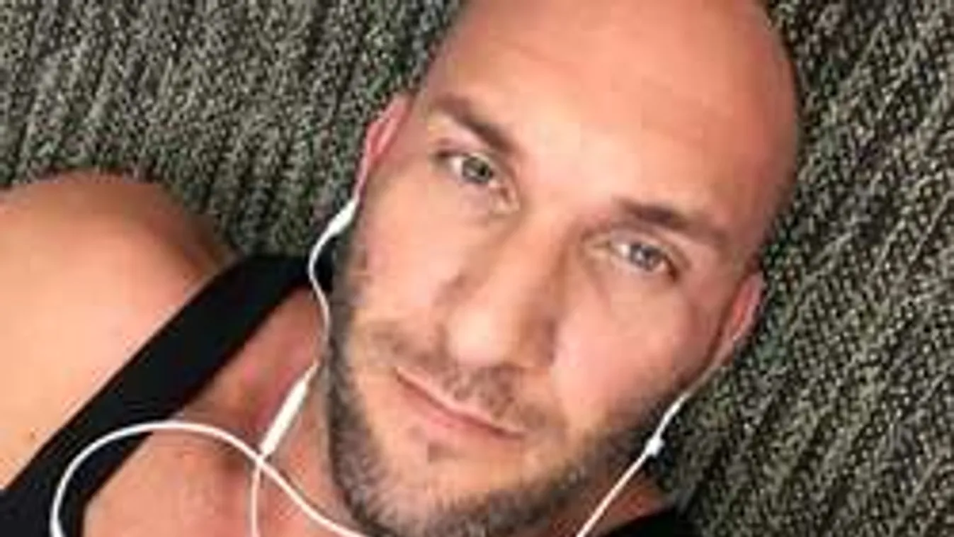 Plasztikai sebészének hálálkodott Berki Krisztián