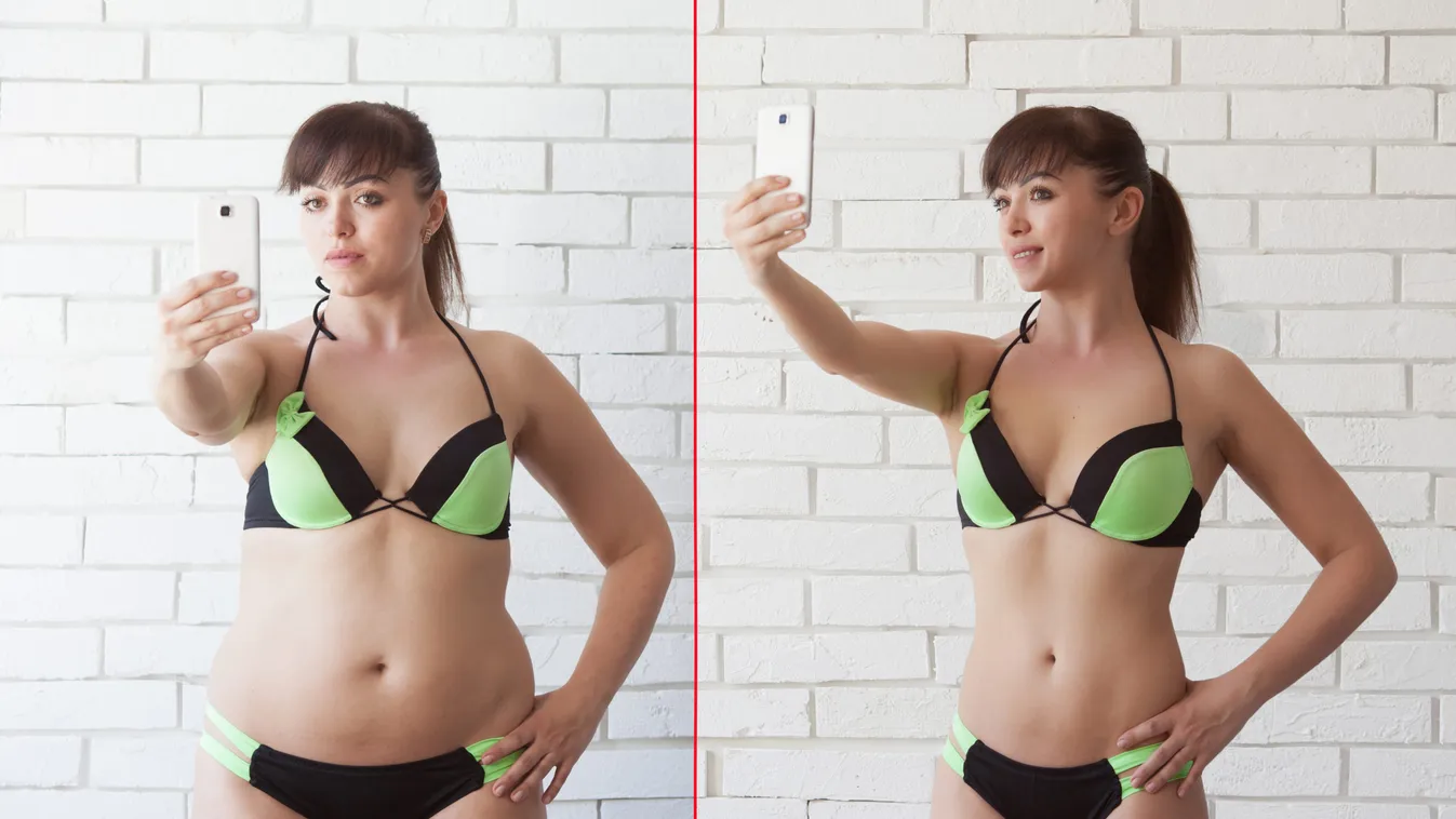 Comparison,Of,Women,Before,And,After,Weight,Loss.,Diet,And