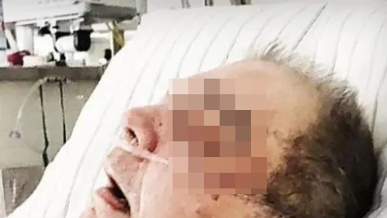 Meghalt a szomáliai migráns által összevert 76 éves nyugdíjas