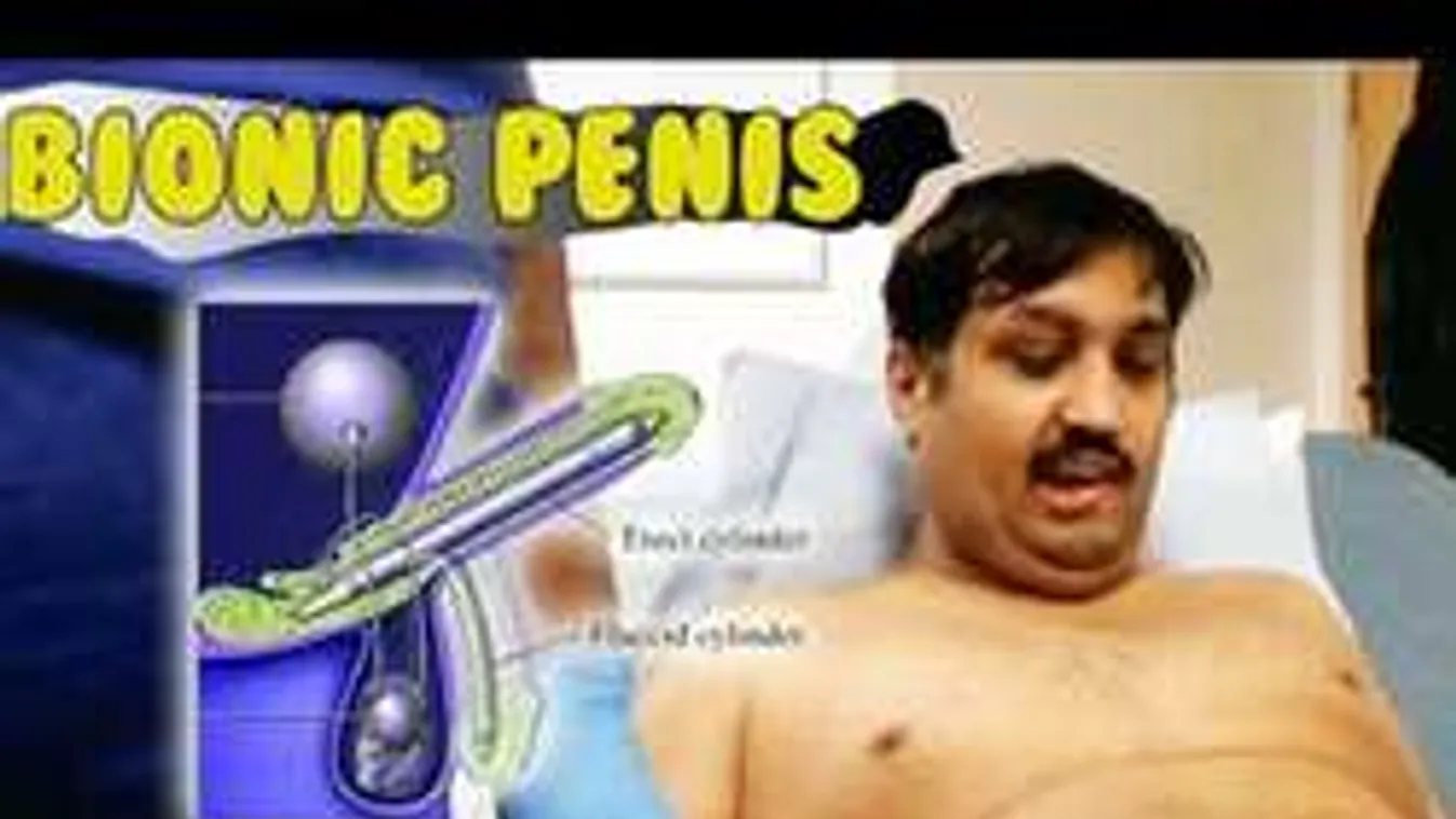 Ingyen szexelhetett a műpéniszt kapó férfi