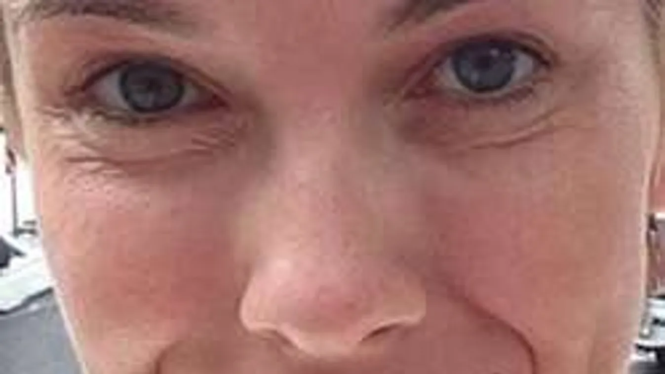 Mi történt D. Tóth Kriszta arcával?