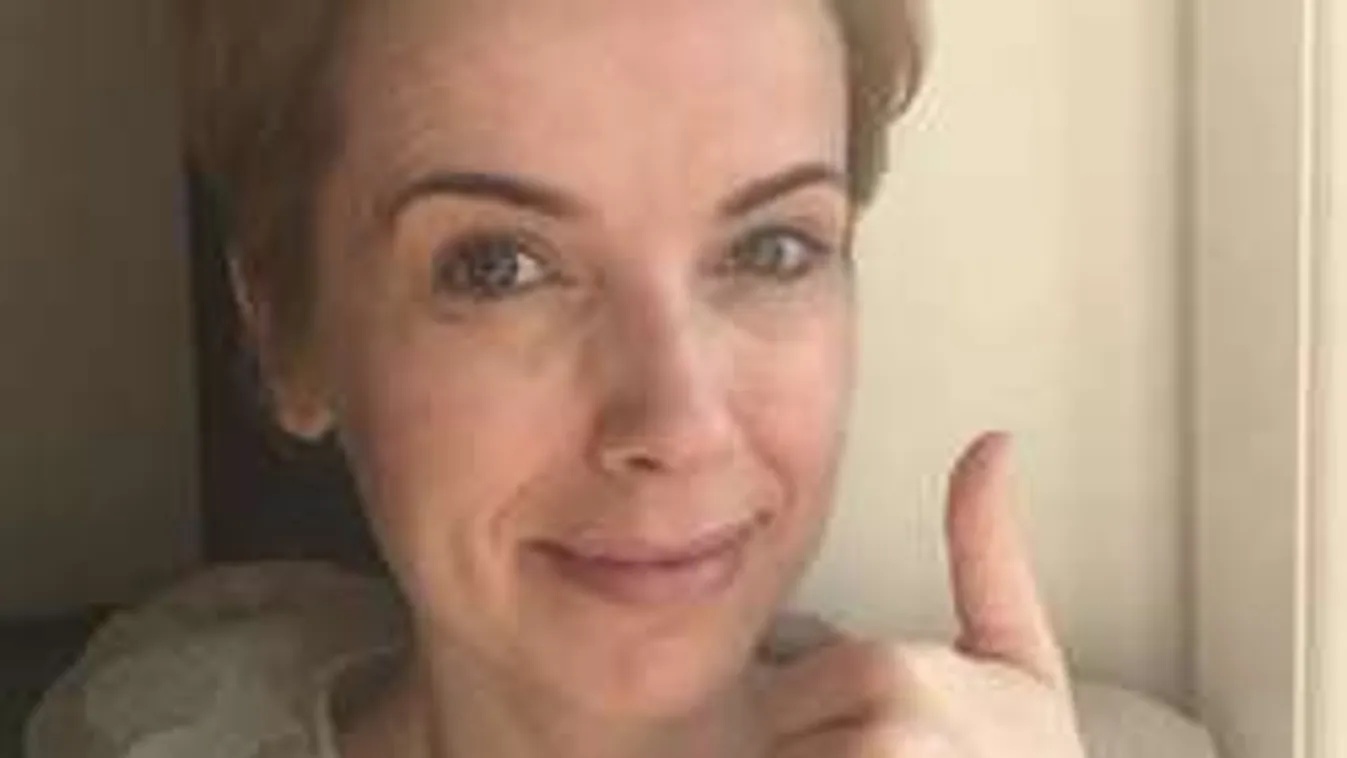 Mi történt D. Tóth Kriszta arcával egy év alatt?