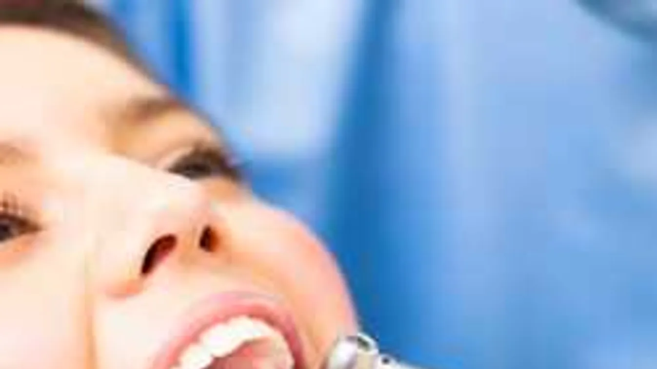 Erről tudsz? Fogpótlást is kérhetsz állami támogatással!