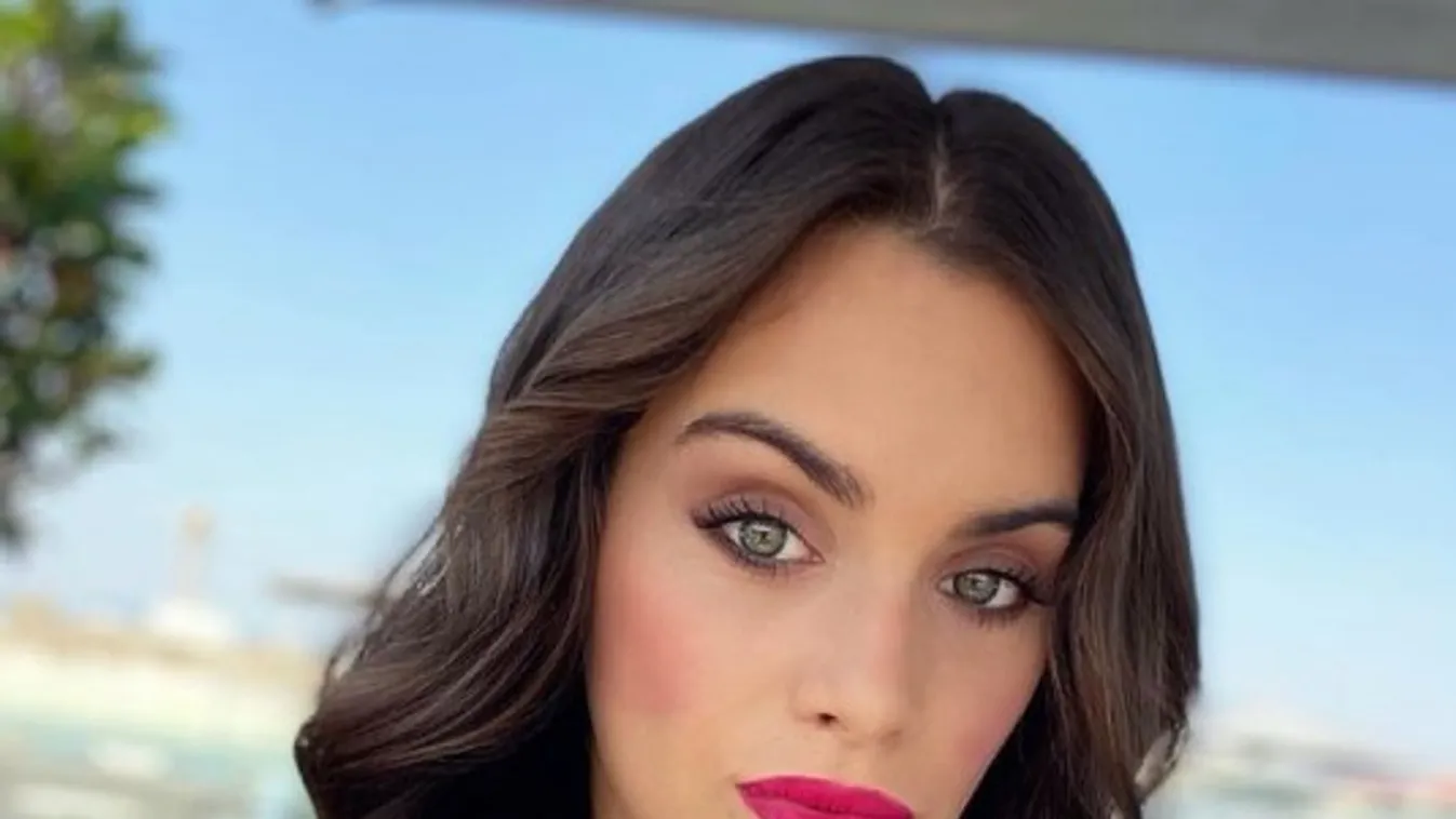 Durva fotó: Ennyire kihullott a betegség miatt Gelencsér Timi haja