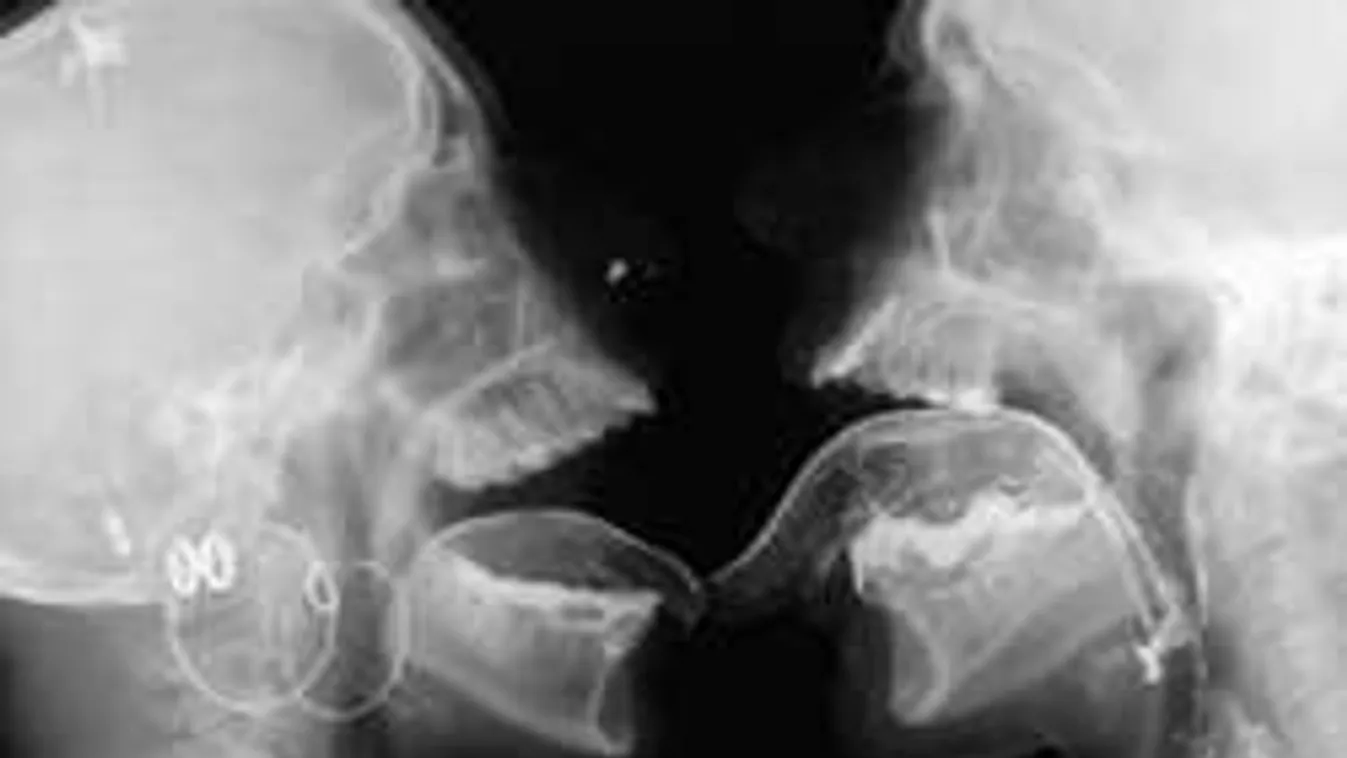 Fantasztikus! Ilyen a szex belülről! - Fotók!