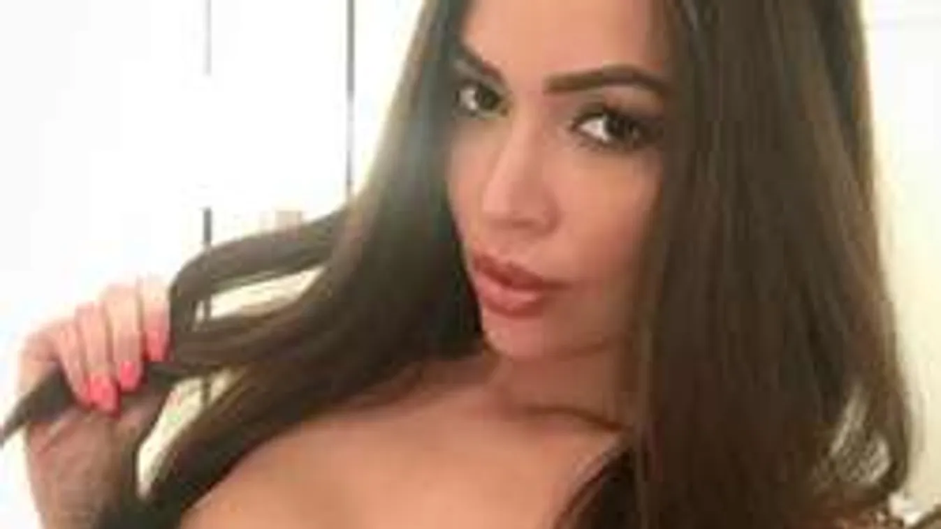 Izgató fotón mutatta meg sérülését a hatalmas mellű magyar modell!