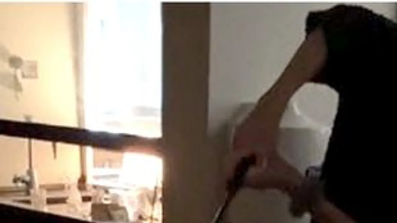 Kiakadtak a szülők: egy TikTok kihívás miatt égett meg a 12 éves fiuk