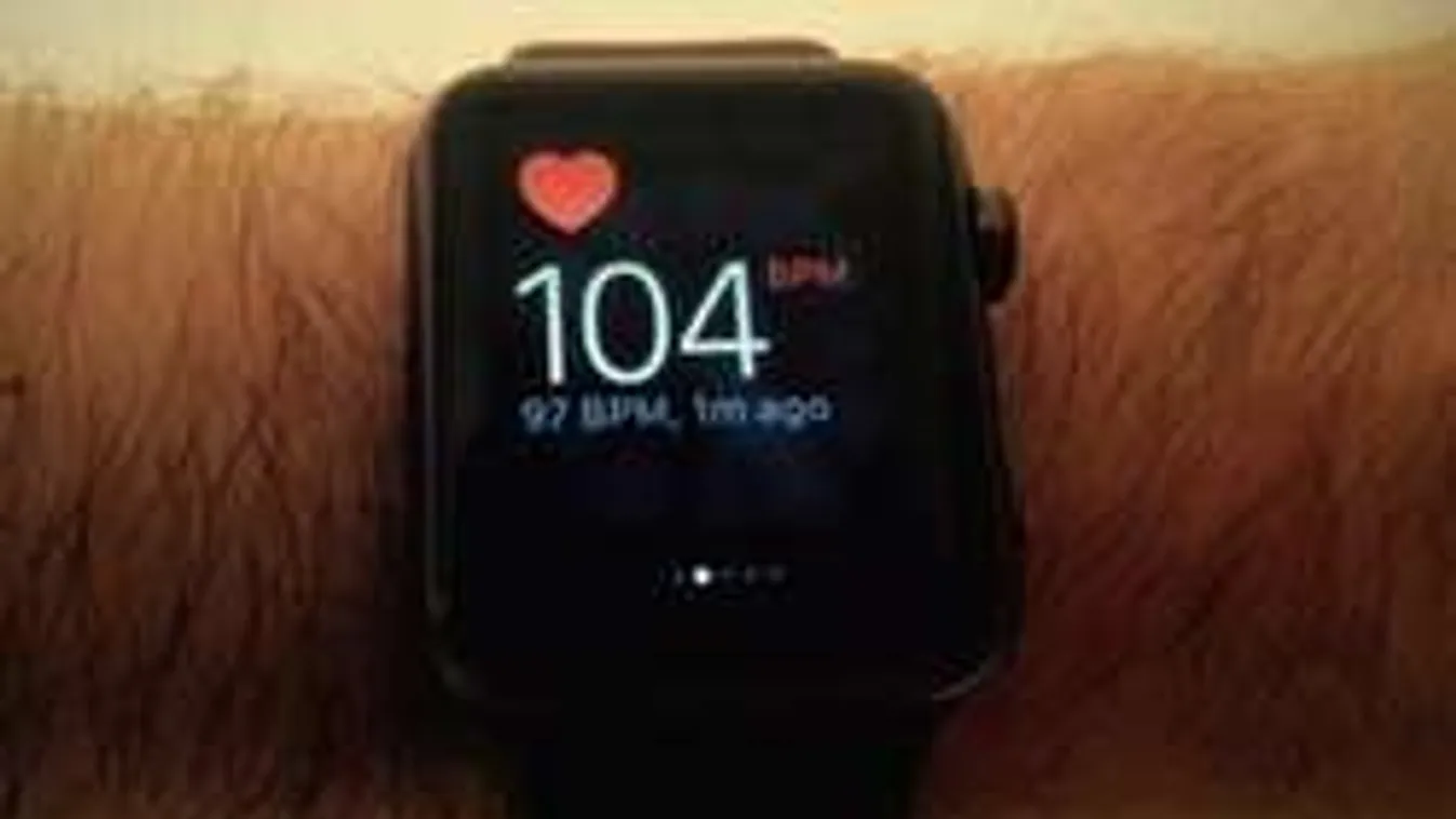 Órája mentette meg a férfi életét, akinek szívrohama volt