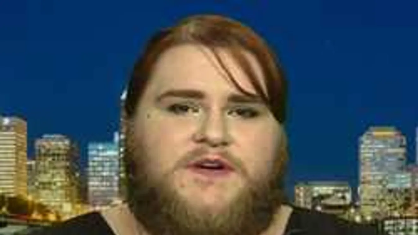 Rémálmaidban sem gondolsz arra, ami ennek a nőnek az arcával történt