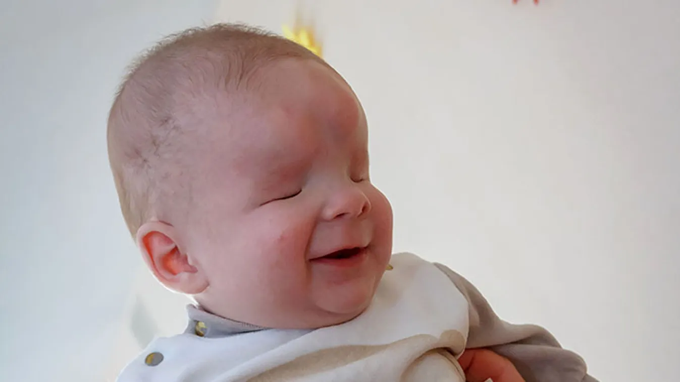 Anyja lemondott róla, családot keresnek a szemek nélkül született kisfiúnak