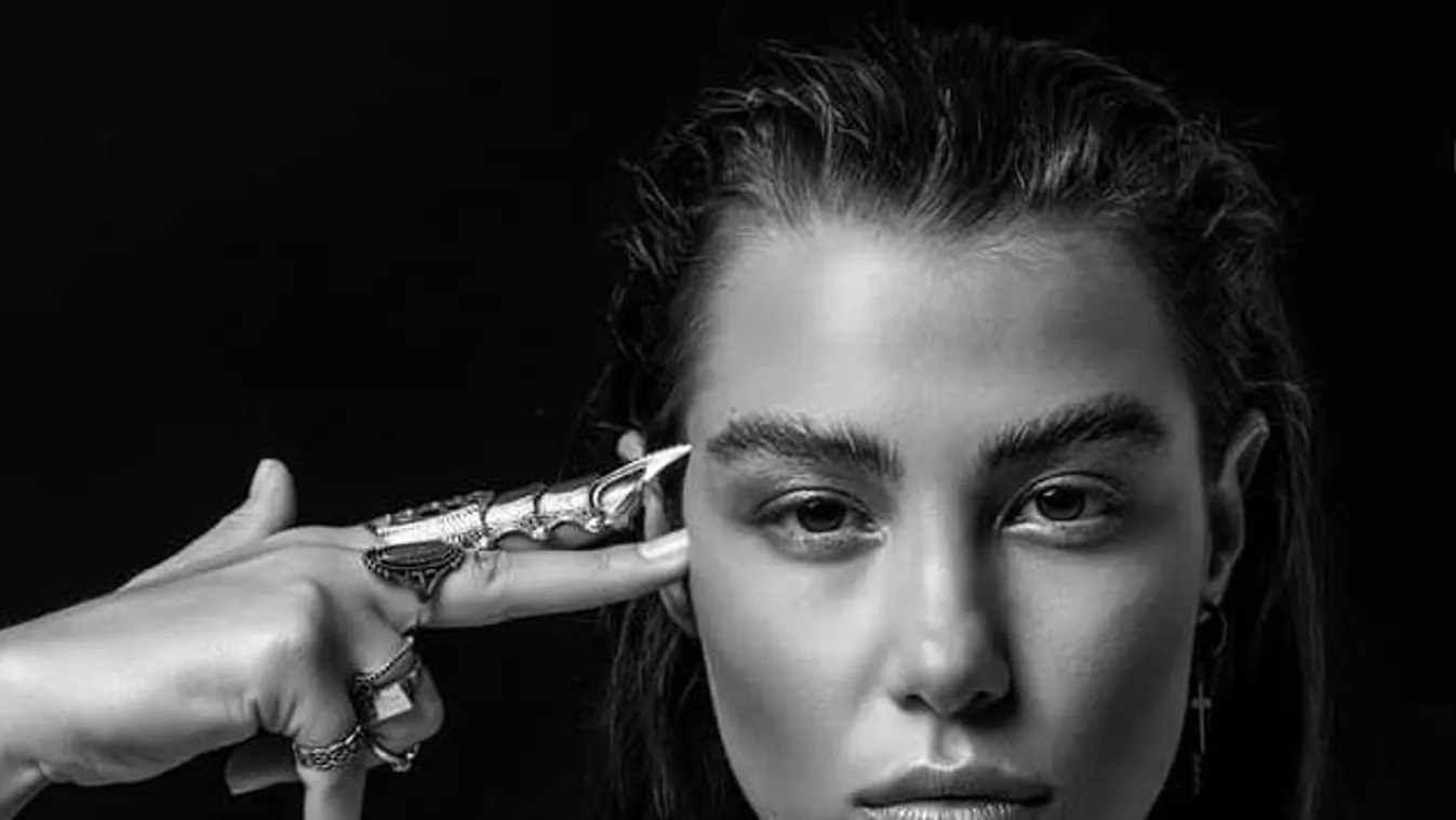 Mostantól foltosbociban tolom: Leégett a bőr Tóth Andi arcáról – Fotó