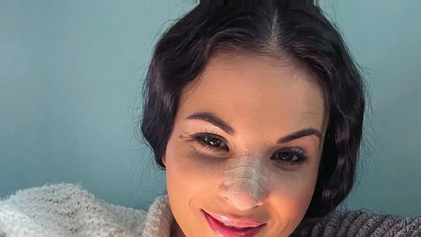 Nádai Anikónak tetszik az új orra