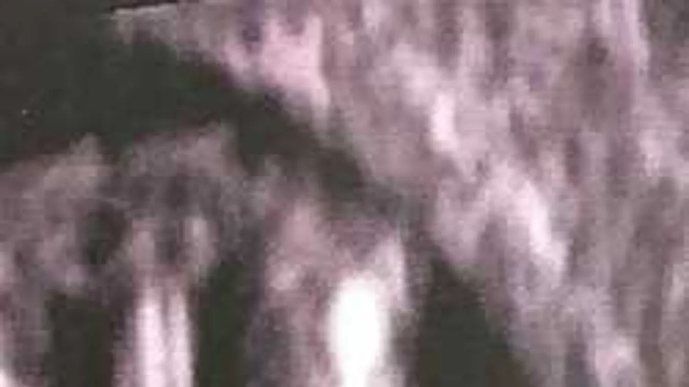 Horror! Ezt a sokkoló ultrahangfotót kapta a terhes nő a babájáról...