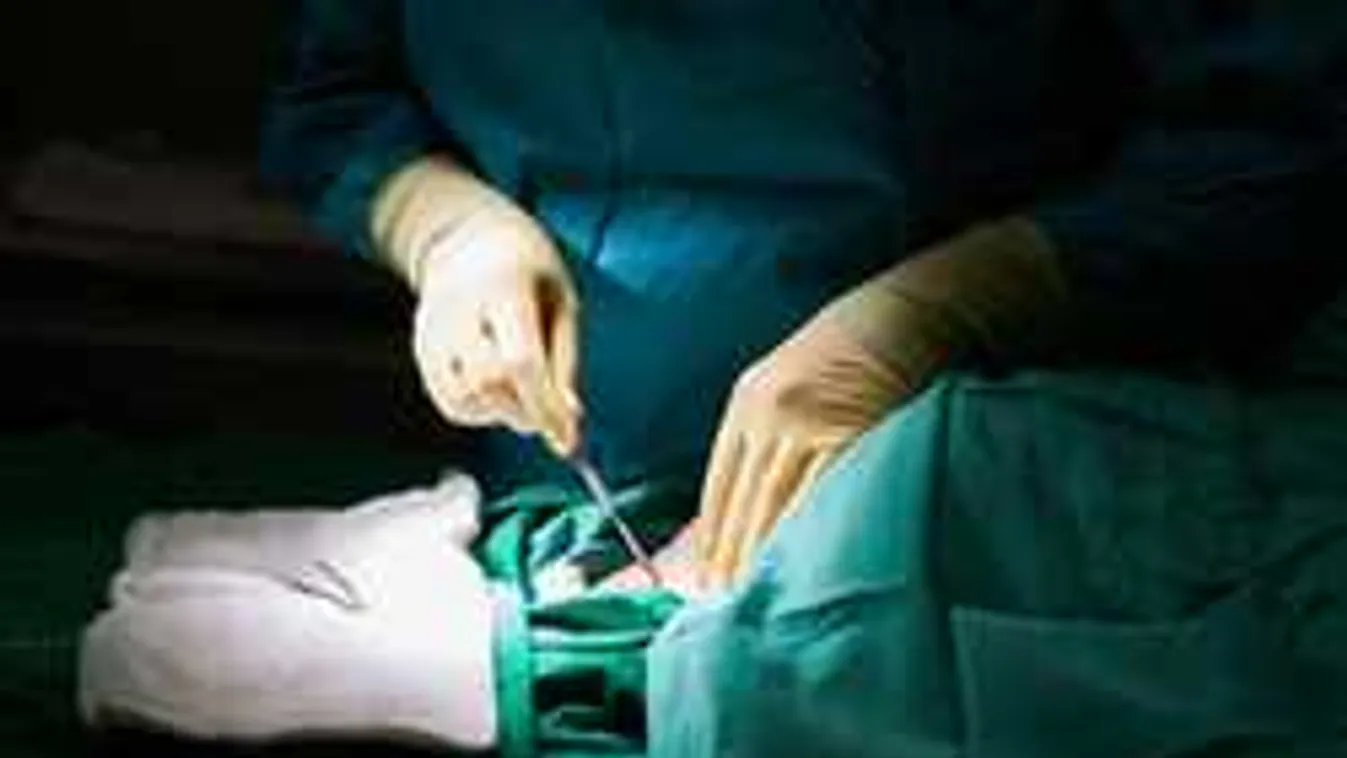 Az orvosok is elképedtek attól, ami a fejfájós férfi koponyájába került