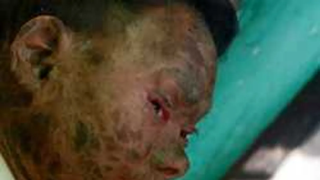 Kígyóbőr fedi a szerencsétlen kamaszt - sokkoló fotókkal