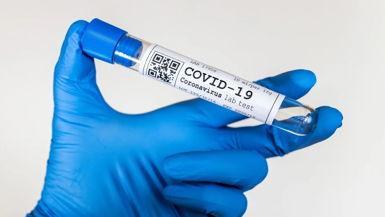 dangerous coronavirus Covid-19 virus in a laboratory - infection of 2019-nCoV virus.  Global pandemic risk due to coronavirus outbreak