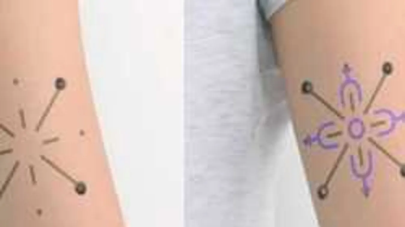 Elképesztő találmány segítheti hamarosan a cukorbetegek életét