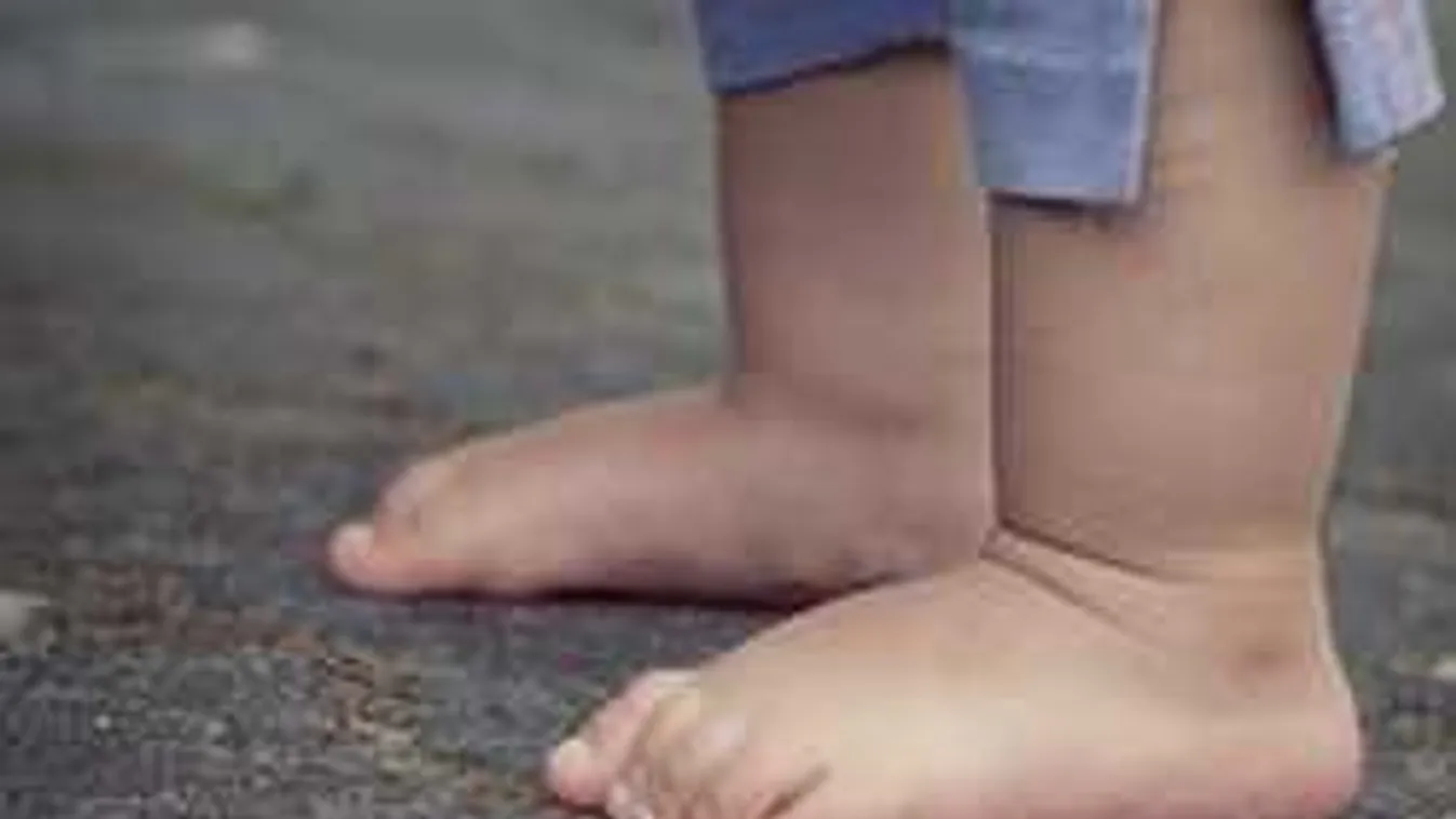 Félig lefejezett kisfiú holttestére bukkantak a kukában