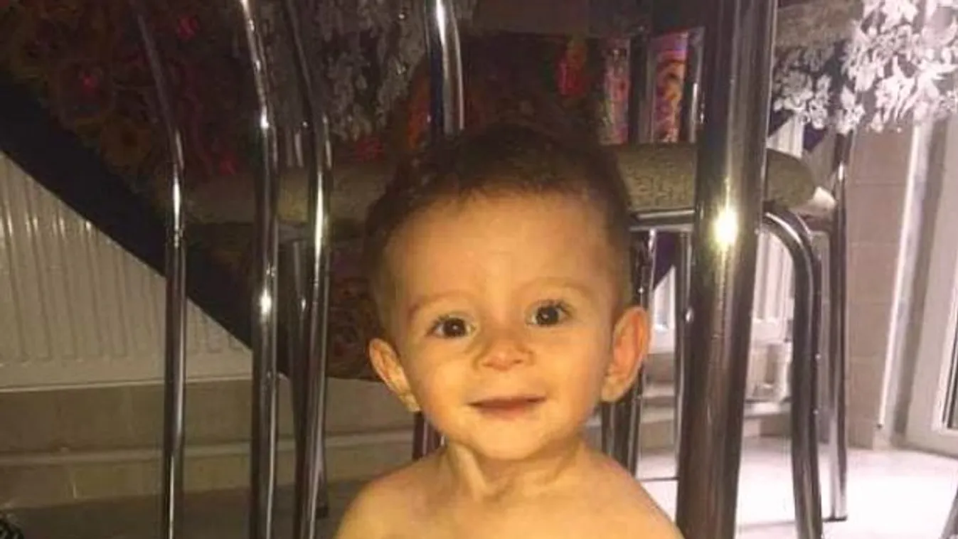 „Nem akarom elveszíteni„ – a másfél éves kisbaba keze és lába óriásira nőtt