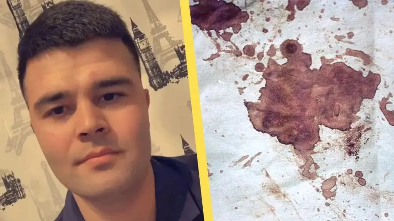 Gyomorforgató: szellemi fogyatékos lányt erőszakolt meg egy afgán migráns