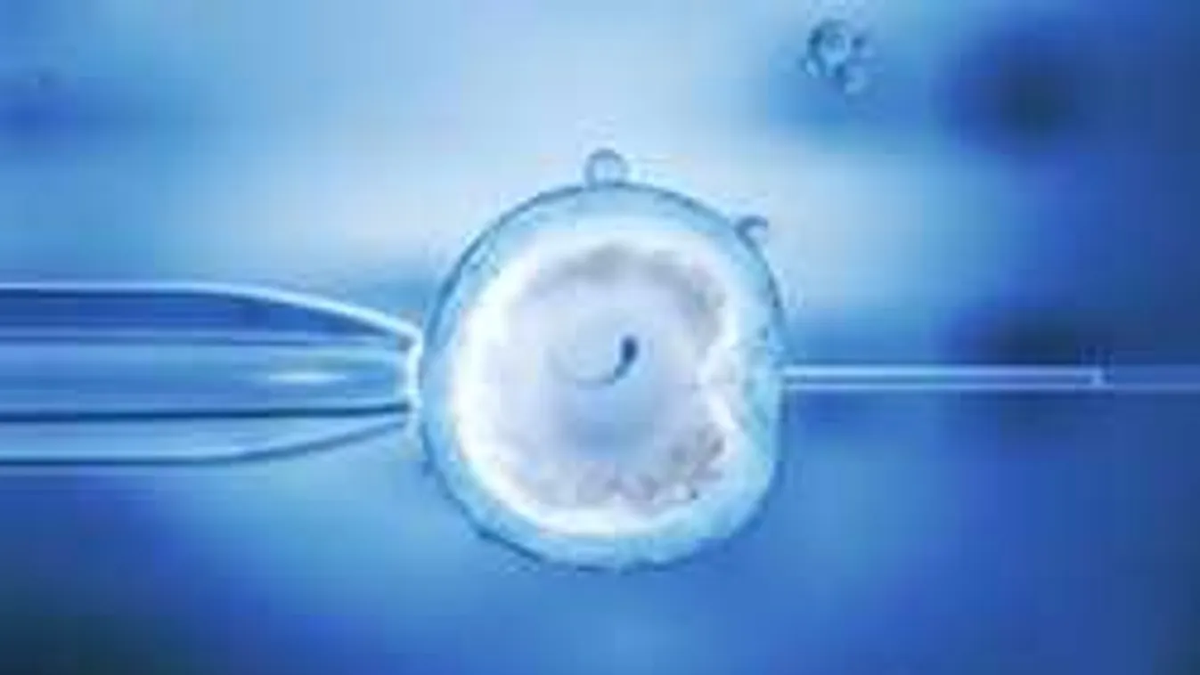 Megrohamozták a lombikklinikákat: valami megkezdődött az új családtámogatással?