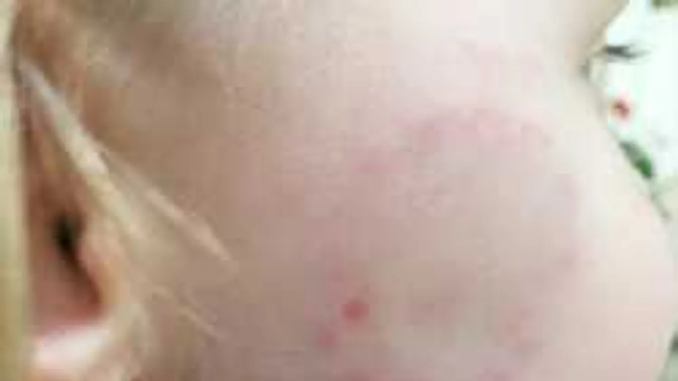 Megszólal a véresre harapdált kislány anyukája