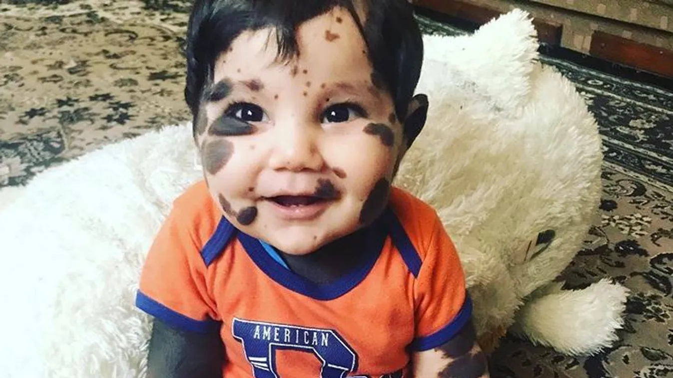 Az orvosok már lemondtak a kisfiúról, azt tanácsolták a szülőknek, hagyják a kórházban