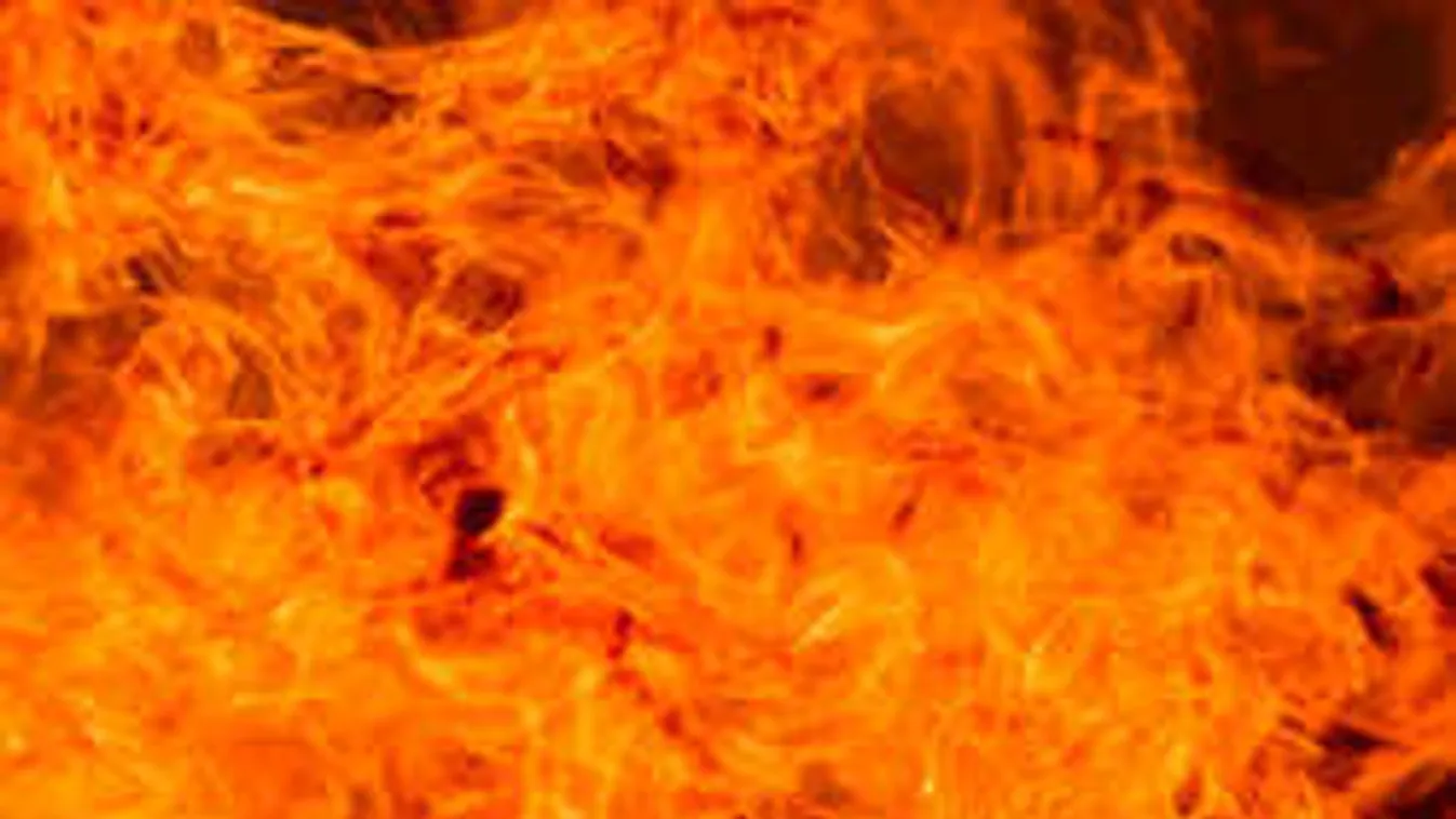 Gyújtogatott egy beteg a pszichiátrián, amputálni kellett a lábát