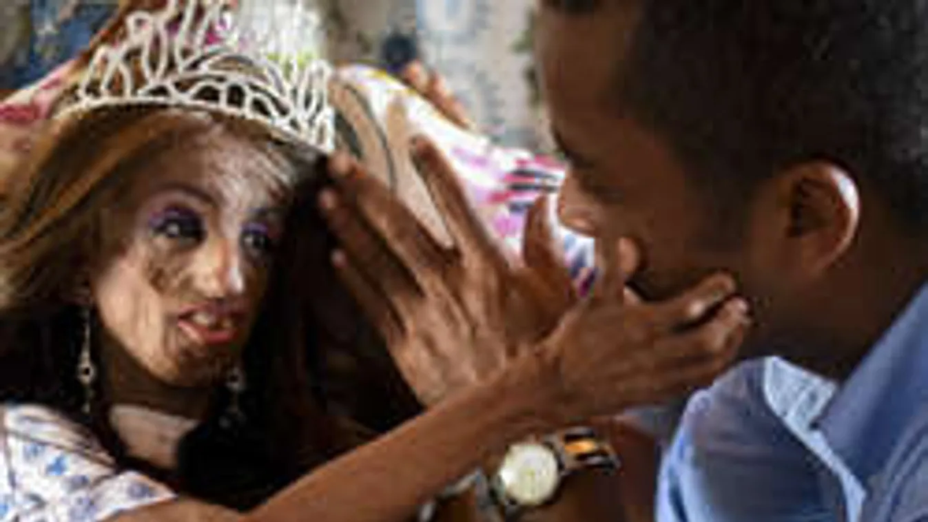 Szívszorító: teljesült a korai öregedésben szenvedő tinilány álma