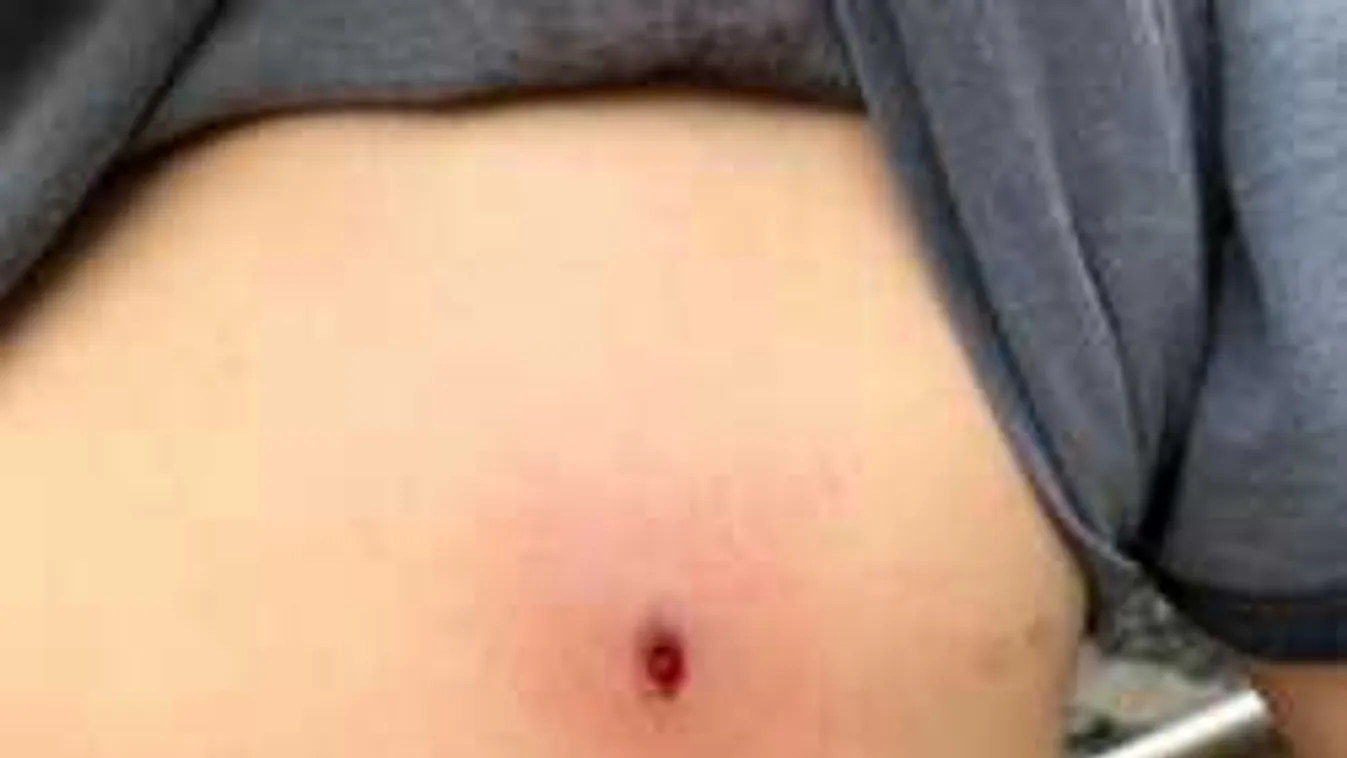 Gyerekekre lövöldözhettek Huszton, kivonult a rendőrség