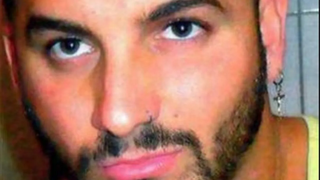 Gyomorforgató lénnyé műtötték a férfit – fotón a végeredmény