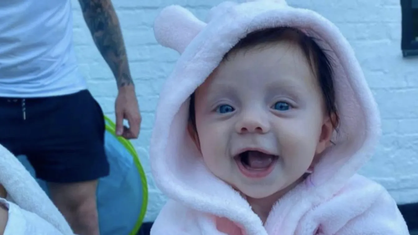 Horrortörténetbe illő, ritka betegségben szenved a gyönyörű 5 hónapos kislány