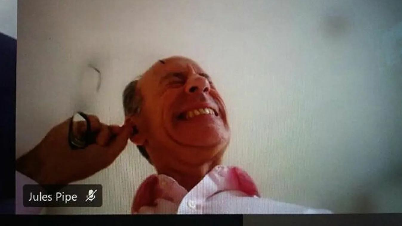 London baloldali alpolgármestere megette a saját fülzsírját egy nyilvános megbeszélésen – videó