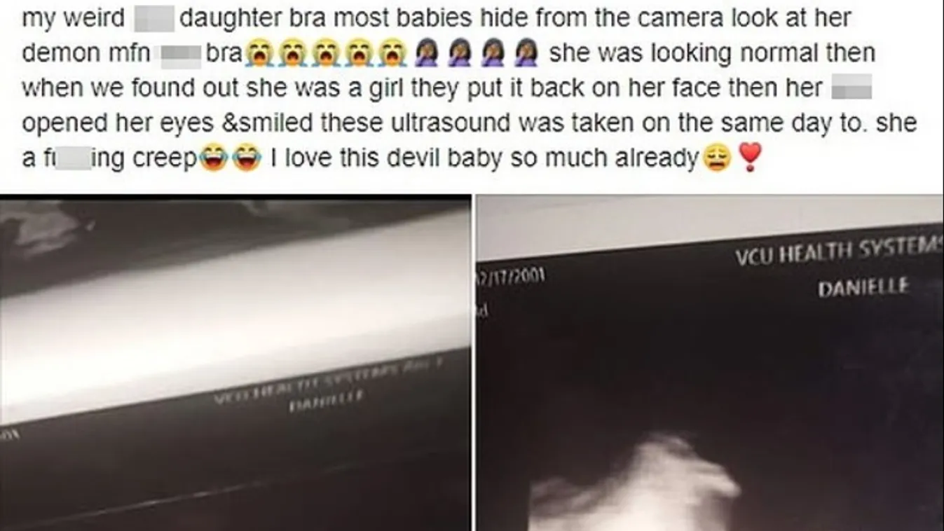 Sokkot kapott a tinilány, amikor meglátta a terhességi ultrahangot