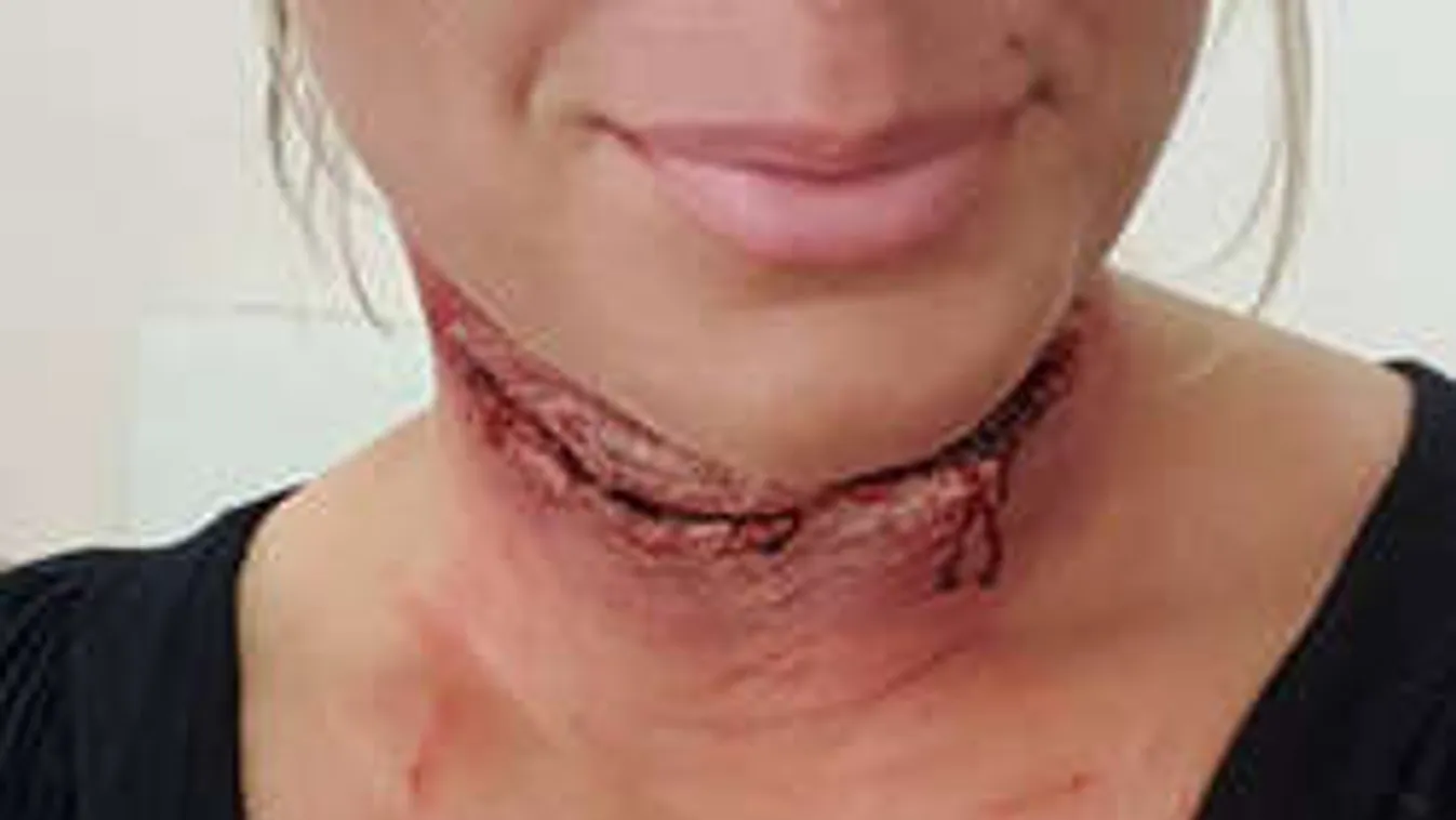 Uhhh, elvágták a Nagy Õ, Molnár Anikó torkát!