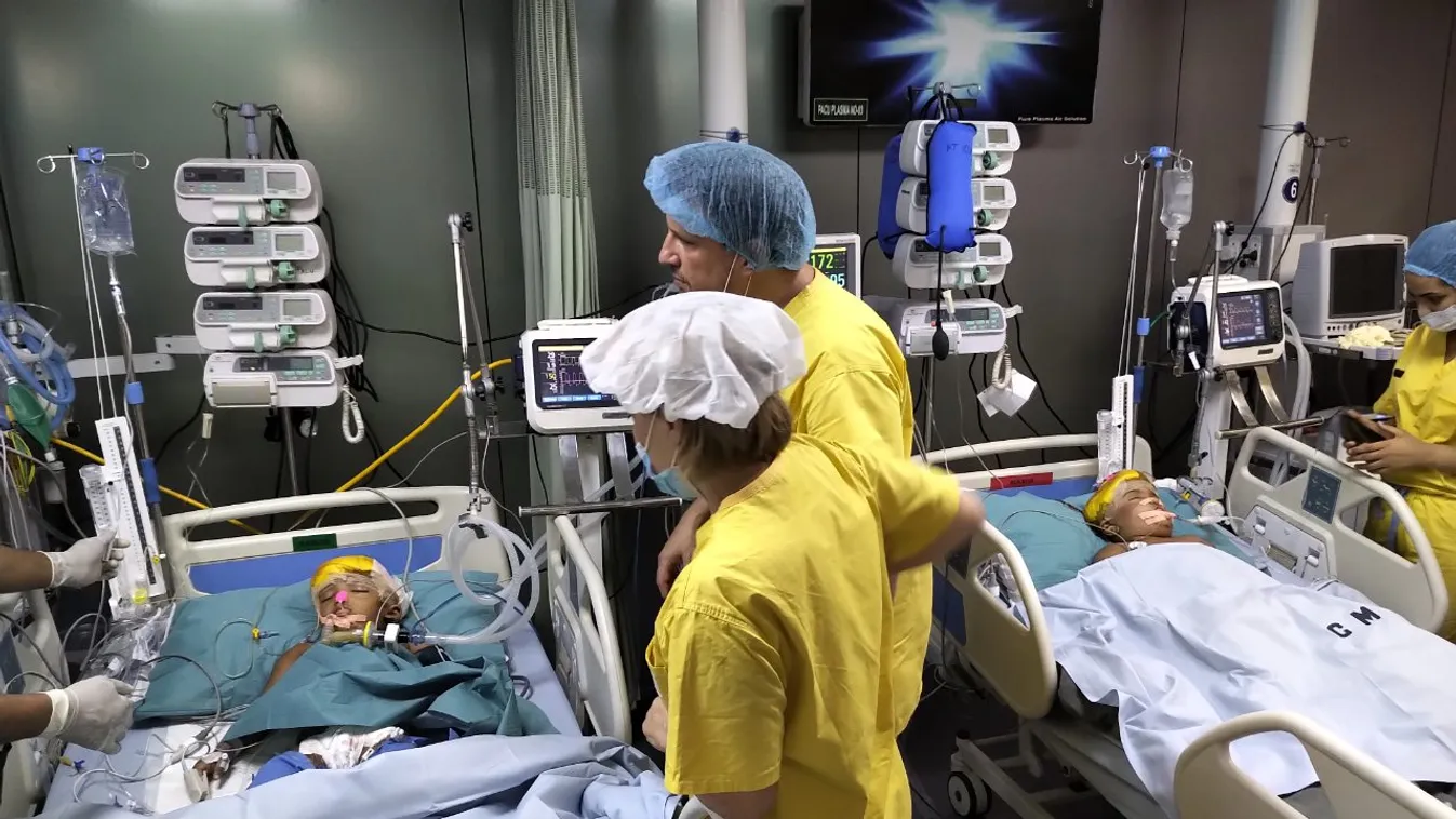 Megszólalt a sziámi ikrek magyar altatóorvosa: még nem múlt el a veszély