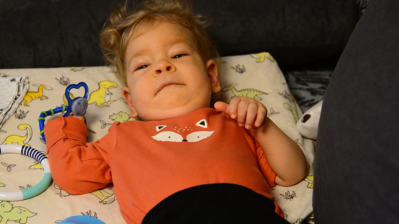 Óriási változás: 1 éve kapta meg a szert SMA-s Zsombi