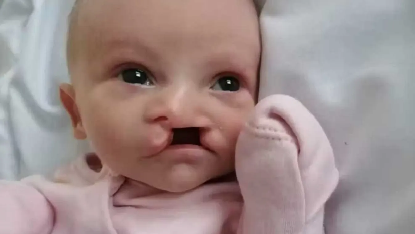  Két napig küzdött az életéért egy kéthetes kislány