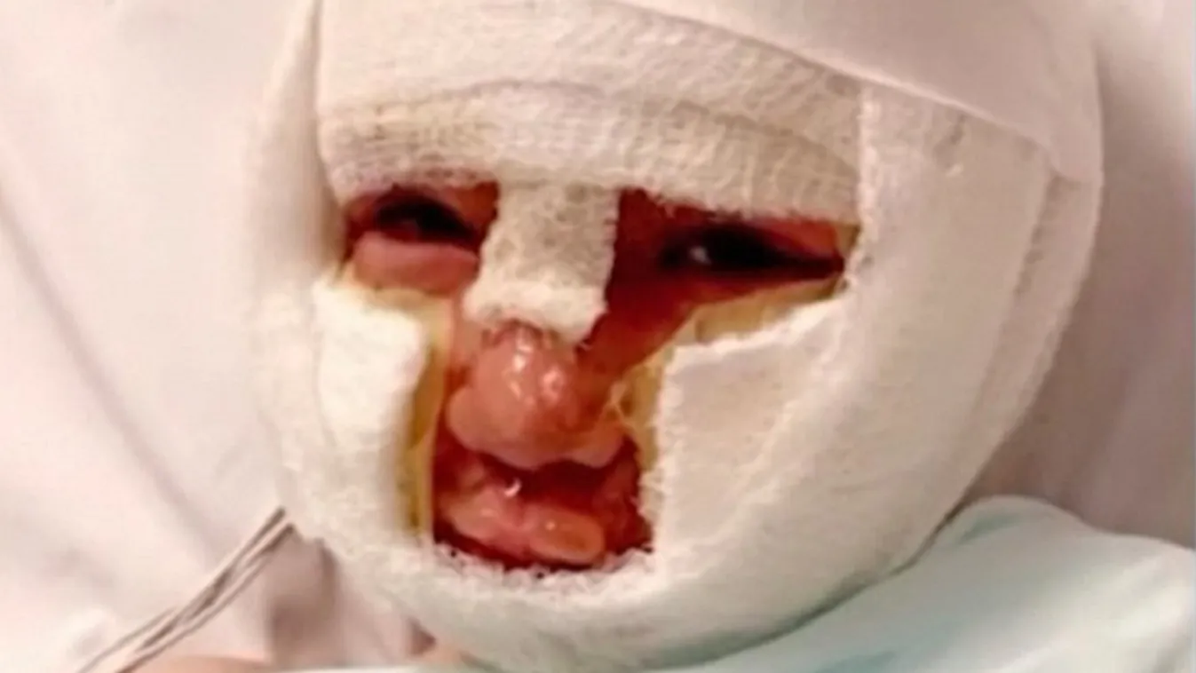 Megégett egy 6 éves fiú a zaklatója miatt