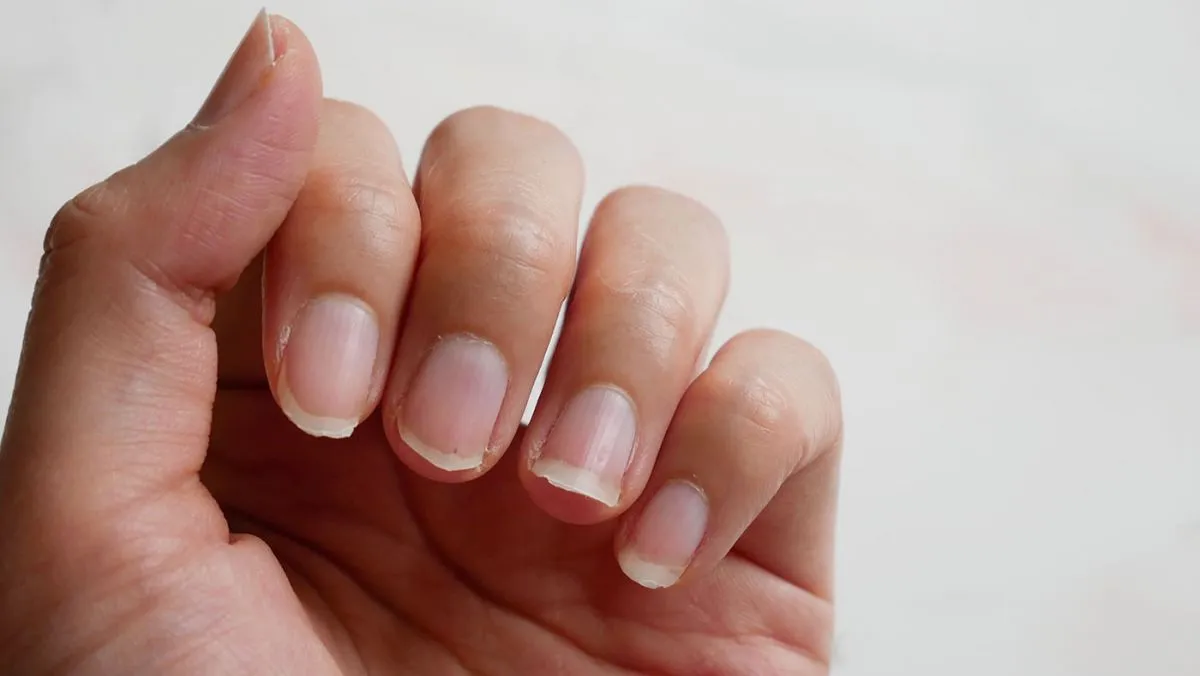 Miért árthat a körömrágás az egészségnek?