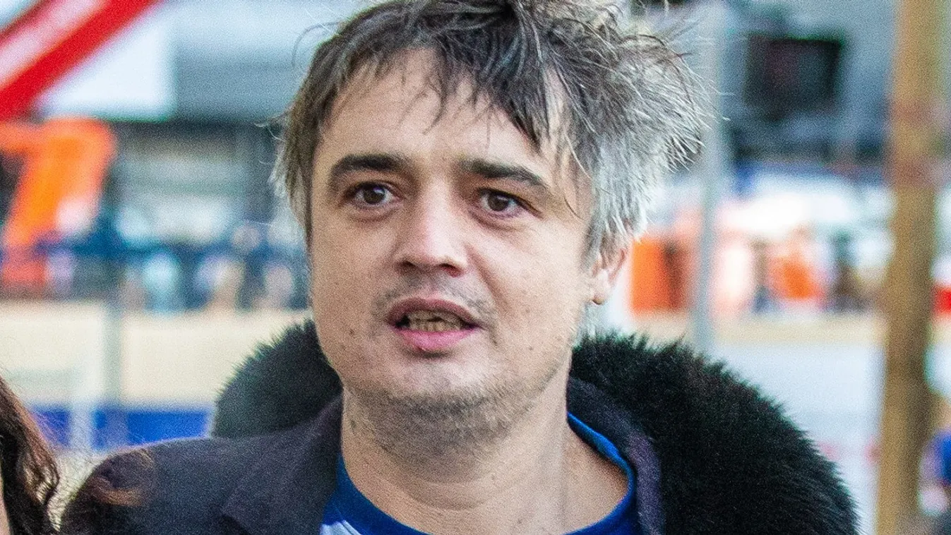 Leharapták a balhés rocksztár mindkét fülcimpáját